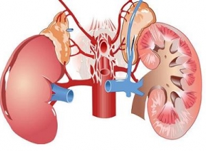 Bệnh hội chứng thận hư ở trẻ em - Những điều cần biết về căn bệnh này